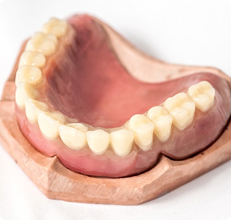 Cast Of Dentures | Chestermere Lifepath Dental | Lifepath Dental & Wellness