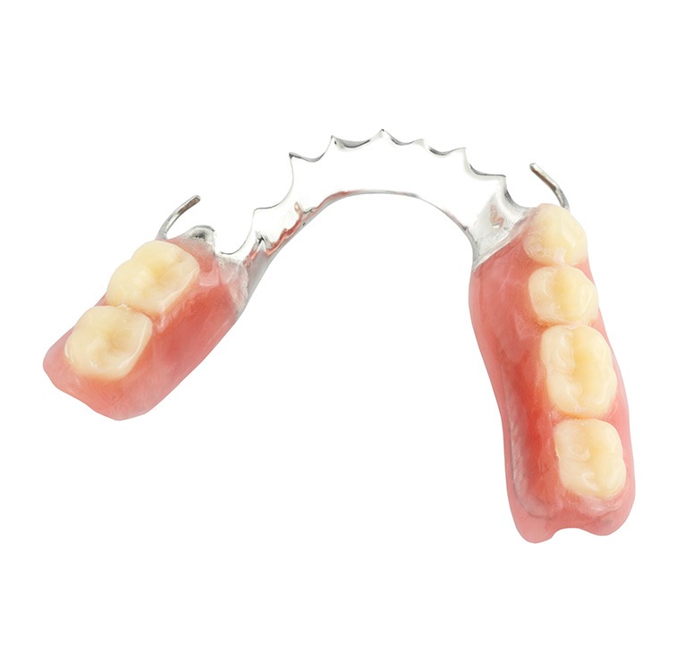 Partial Dentures | Chestermere Lifepath Dental | Lifepath Dental & Wellness